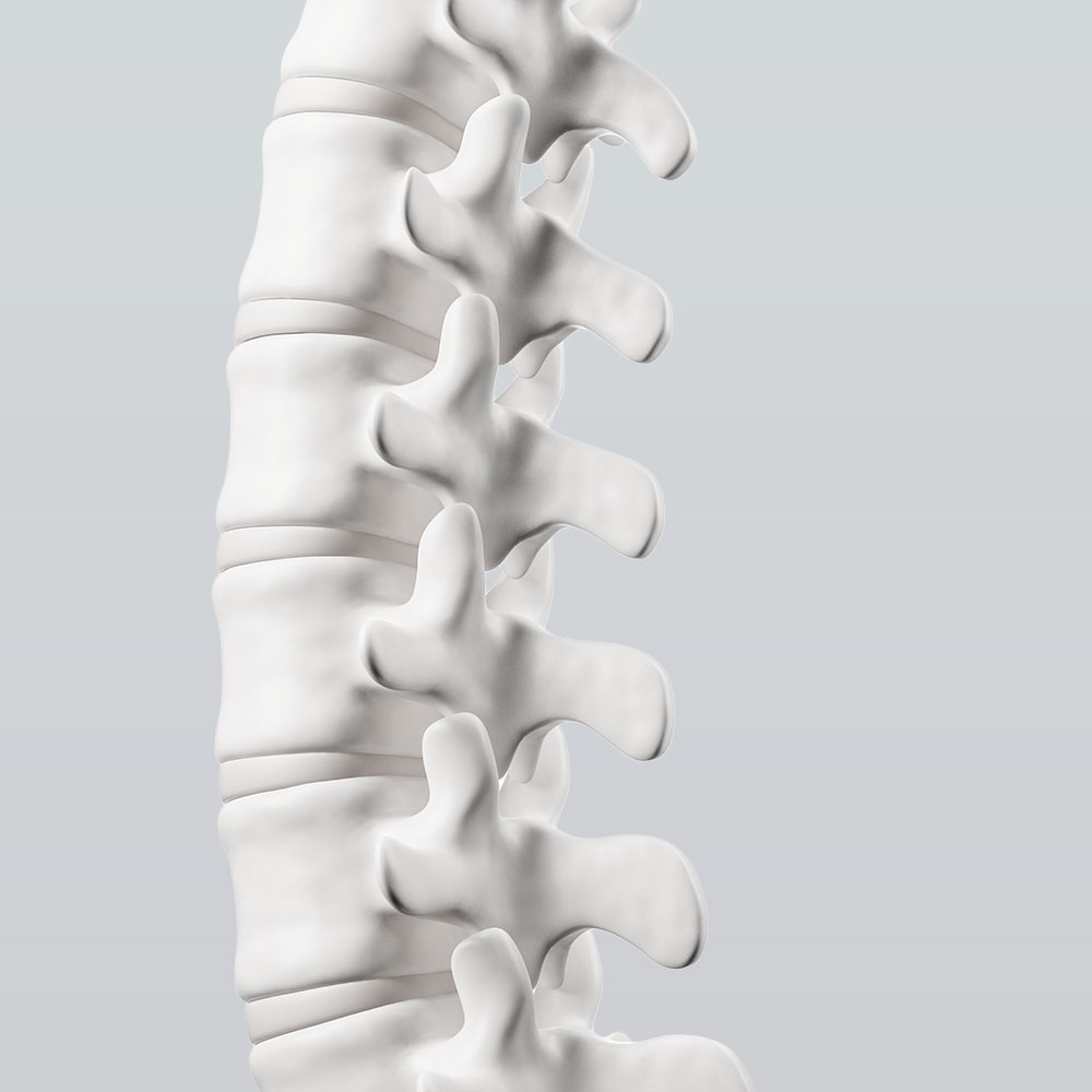 MRT Wirbelsäule Frankfurt